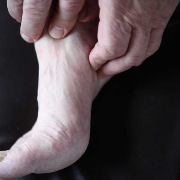 מדרסים לפלטפוס מדוע מדרסים הם טיפול ולא מוצר