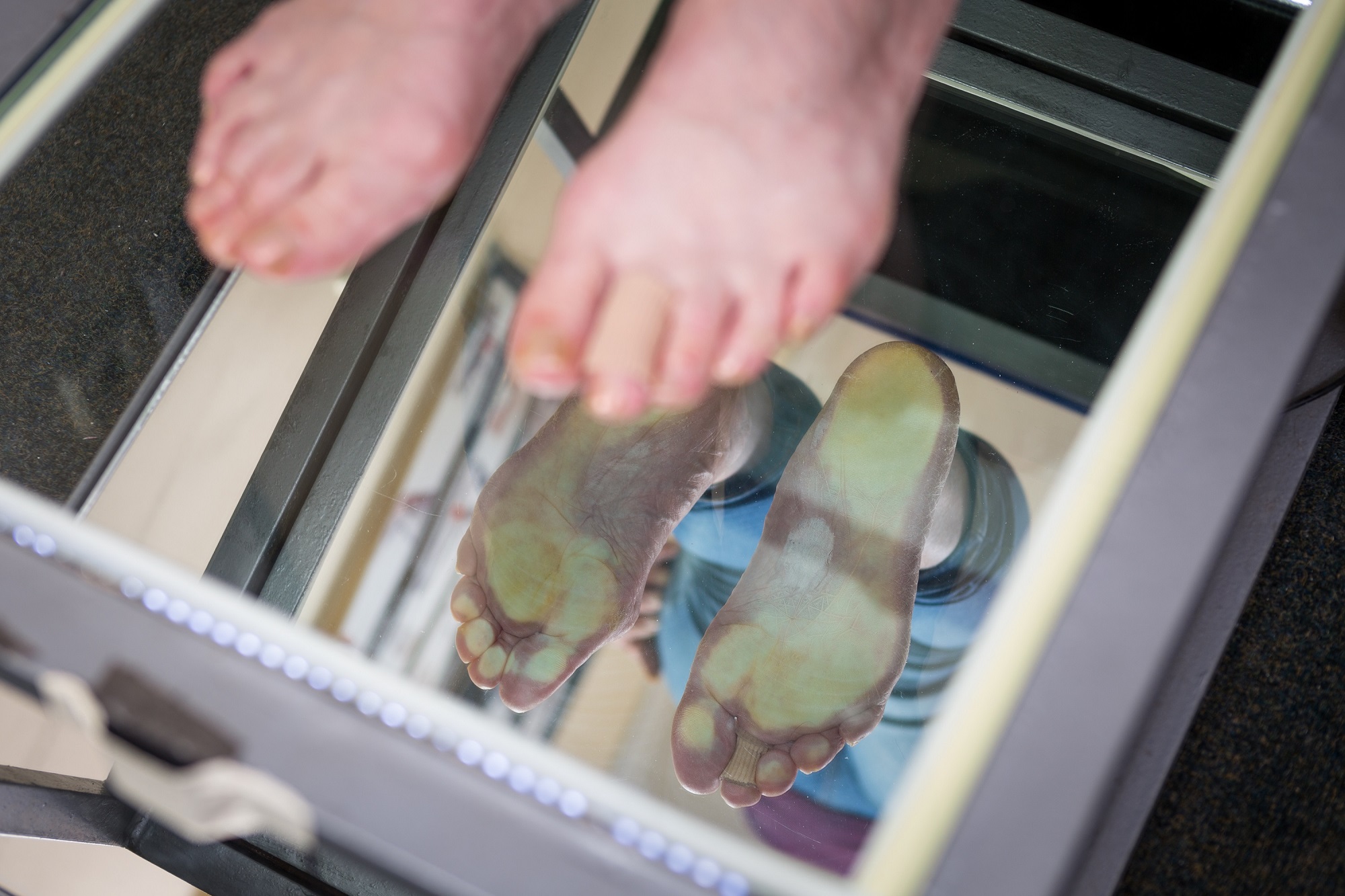 Read more about the article חנות מדרסים אורטופדיים בירושלים