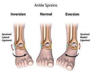 מדרסים לבעיות מכניות בכף הרגל